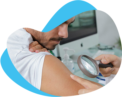 Kurzajki i zmiany skórne